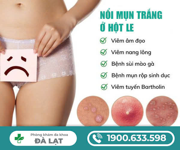 Hình ảnh minh họa